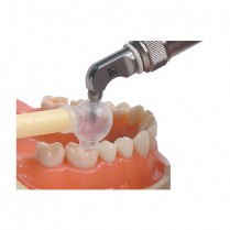 391-22006 Sandtrap Disposable Trap For Microetcher (15)