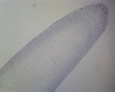 115-3333 Onion Mitosis, Lateral Section, Showing All Stages