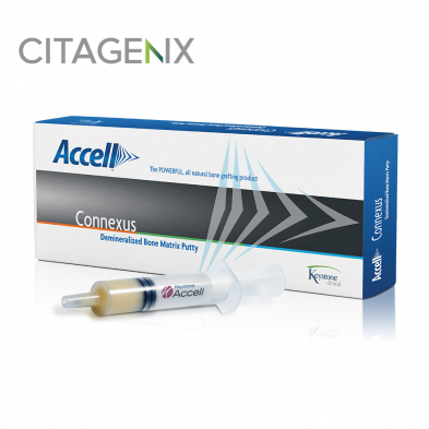  Accell® Connexus