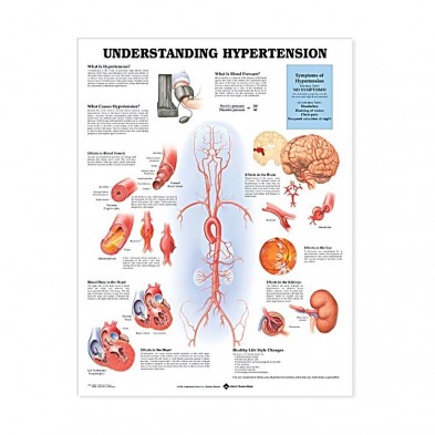 EM-6502-4225 Understanding Hypertension Laminated Poster