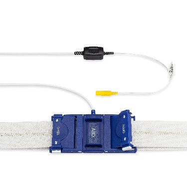 NR-3400-9251 SLP Disposable Inductive Buckle - Abdominal (keyhole)
