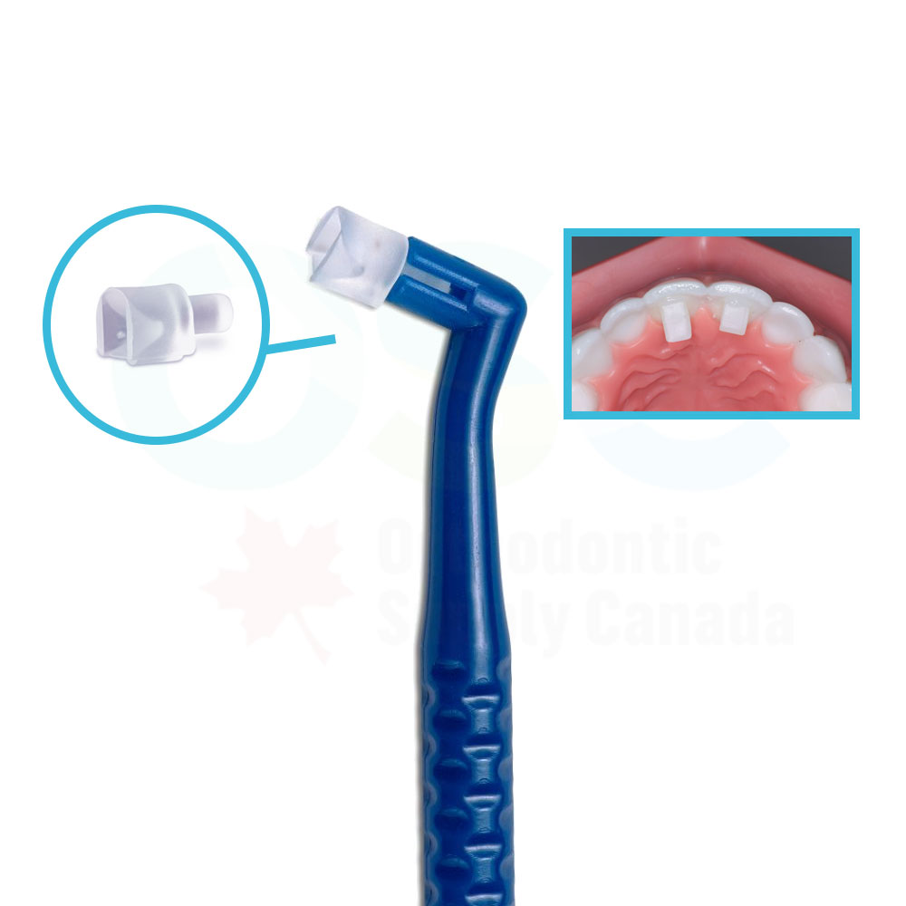 Reliamold Bite Ramp 5mm Attachment (25/Each)