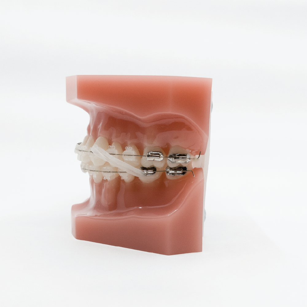 IntraOral NonLatex Elastics 5/16" Medium4.5ounce(50 Bags)