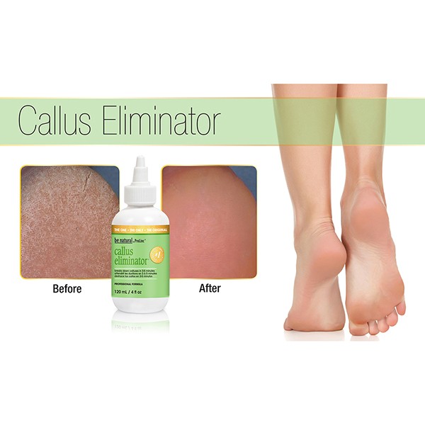 Prolinc Callus Eliminator 1 Gallon