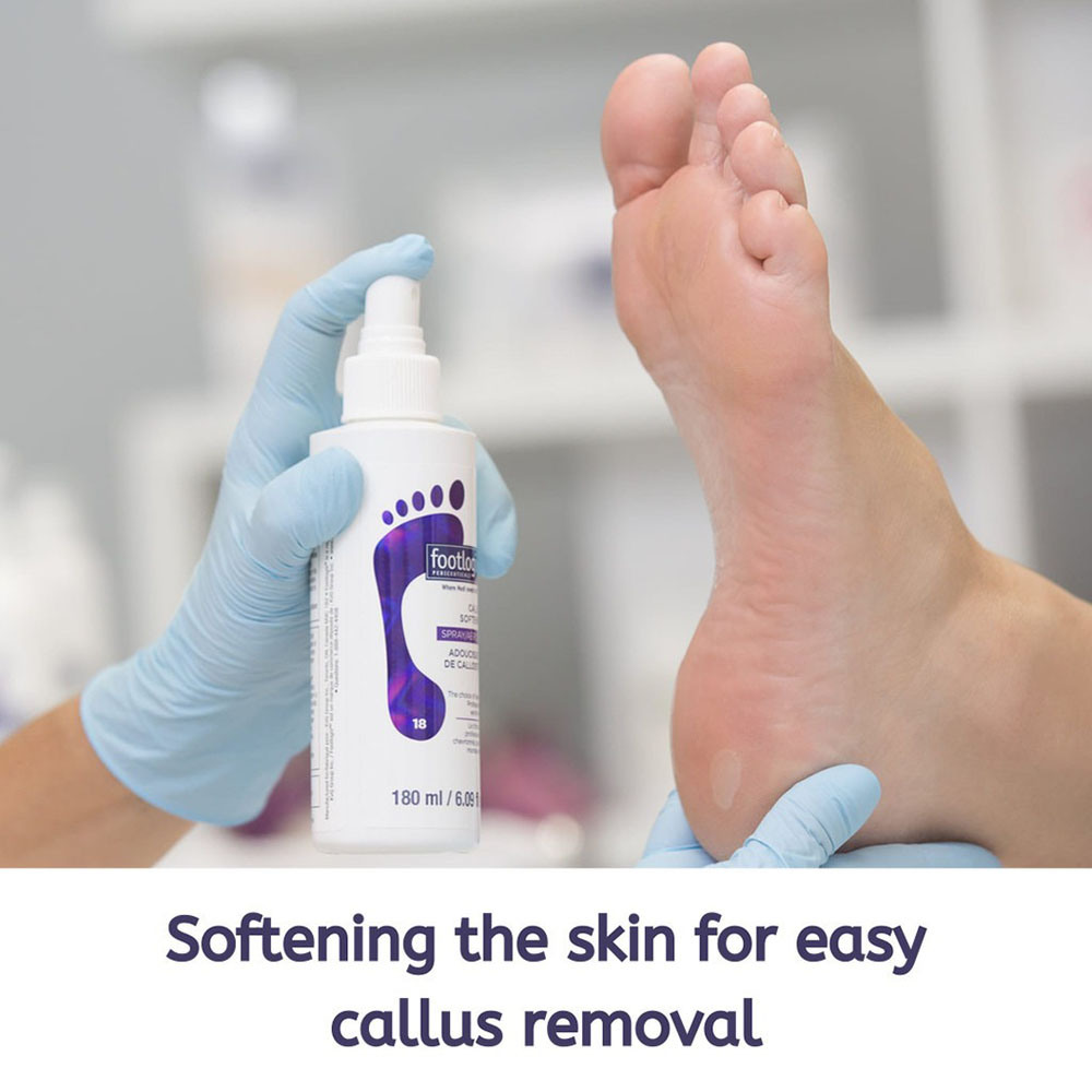Footlogix Callus Softener Spray Swan Beauty Shop