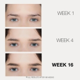 BrowFood Phyto-Medic Eyebrow Enhancer 5 ml BFPM-EB-N / 01790