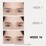 BrowFood Phyto-Medic Eyebrow Enhancer 5 ml BFPM-EB-N / 01790