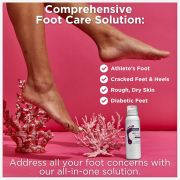 Footlogix Rough Skin Formula (7+) Mousse  4.23 oz.  21131