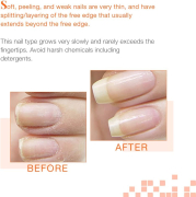 NailTek Intensive Therapy 2 Strengthener 15ml - 4Pack #55808