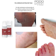 Podoexpert Dry, Reddened And Itching Skin 125 ml 10605436