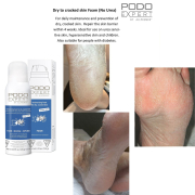 Podoexpert Dry To Cracked Skin Foam W/Out Urea 125ml10607436