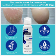 Footlogix #3+ Cracked Heel Formula Mousse 4.23 oz. 04131