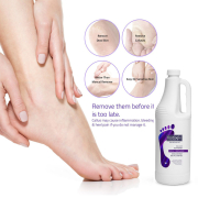 Footlogix #18 Callus Softener Spray 32 oz/946ml 41141