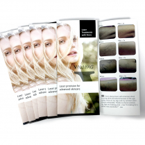 Patient Brochure - Viora V-Nd:YAG Laser Precision for Advanced Skincare TriFold