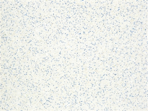 Sider-Proof roll on pool plaster - Speckled Blue