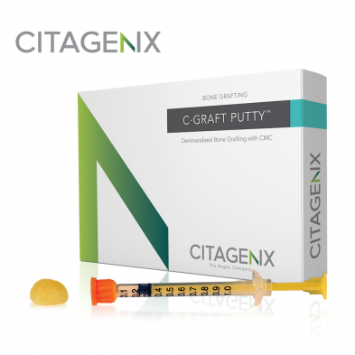 C-Graft Putty |  Demineralized bone matrix