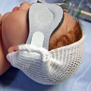 	Bili-Bonnet Phototherapy Mask