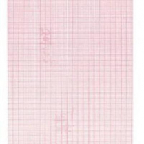 Graphic Controls® ECG Paper Chart, CP100, 200, 150, 250