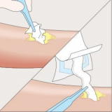 Mesalt® Sodium Chloride Dressings