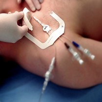 Tegaderm HP Trans. Film Dressing 6" x 6" 100/box