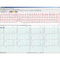 PRO Level Software DR400