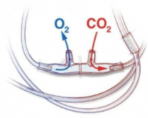 Salter Nasal Cannula, Infant, Div. O2 & CO2 - 25/case