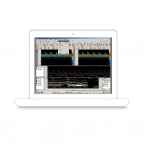 Upgrade CO2/Vasometer